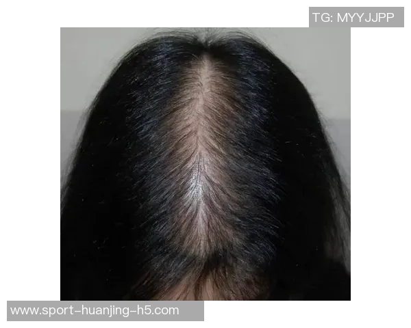 霍华德调侃布朗发际线问题推荐Tony助力解决秃顶烦恼